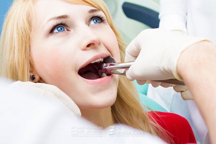 15 Mituri și fapte despre canalele dentare, stomatologia americană la Moscova - este util să știm