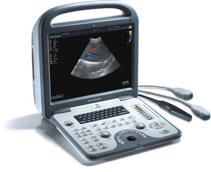 ultrahangkészülék - berendezések pontos diagnózis, orvosi bennfentes