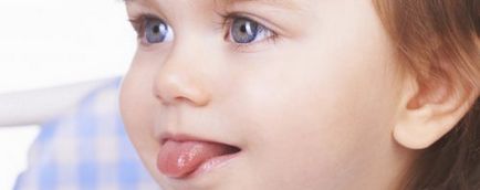 Durerea în limba copilului, simptome, cauze, boli posibile, tratament