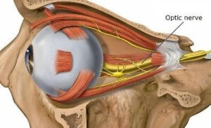 Atrofia parțială a nervului optic - tratament și simptome la copii și adulți
