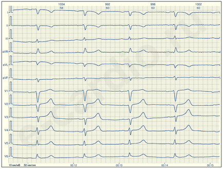 E-cardio урок 1 (що не попась в халепу)