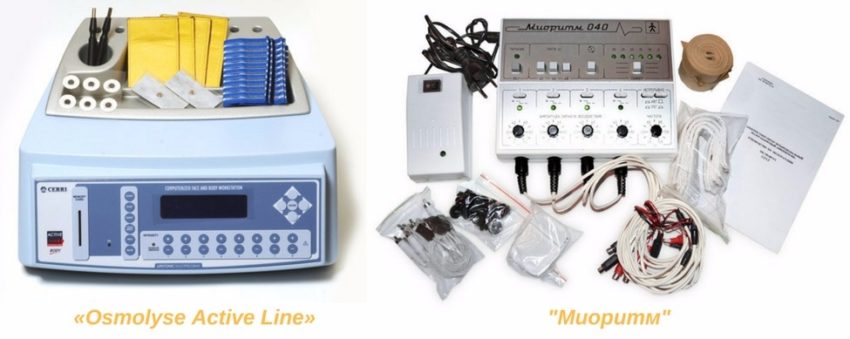 Electrolioliza înainte și după procedură, acul sau dispozitivul electronic, cum este procedura,