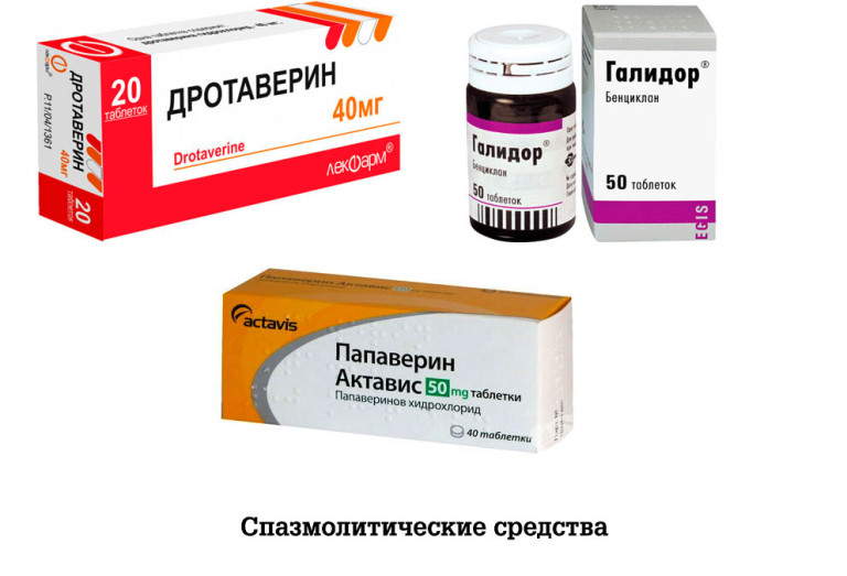 Ендоміометрит що це таке, причини, симптоми і як правильно лікувати