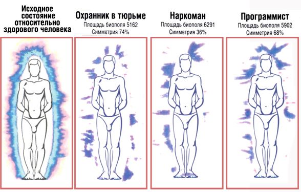 Фотографії аури за методом кирлиан, чакри - savęs pažinimas