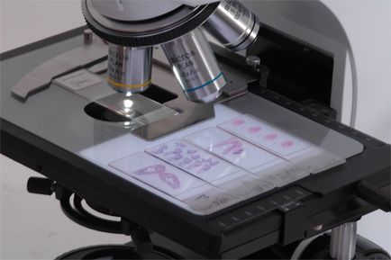 Cum să folosiți un microscop, cum să configurați un microscop, să lucrați cu un microscop, să reglați microscopul (selectați un microscop) Cum să folosiți un microscop, cum să configurați un microscop, să lucrați cu un microscop, să ajustați microscopul