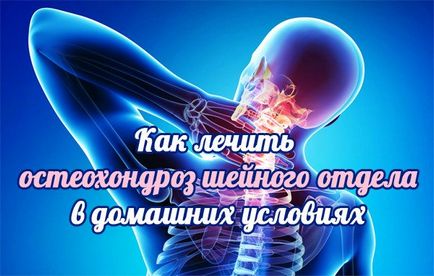 Як лікувати остеохондроз шийного відділу в домашніх умовах