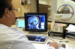 Як проходить МРТ головного мозку