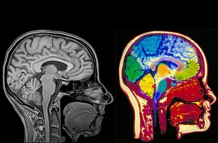 Cum trece creierul creierul
