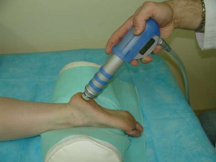Кісточки на ногах методи фізіотерапії, компетентно про здоров'я на ilive