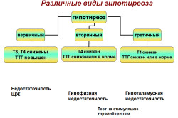 Hypothyreosis kezelése népi jogorvoslati otthon (fotók és videó)