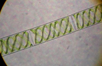 Drug alga Spirogyra
