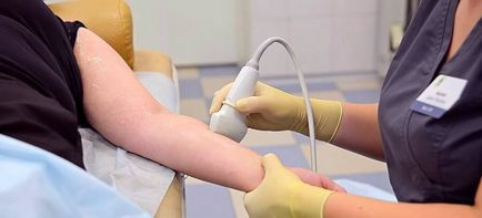 Limfostazia mâinii după îndepărtarea tratamentului glandei mamare după mastectomie, erizipel,