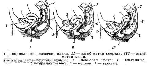 Матка вкінці, мітки вагітність