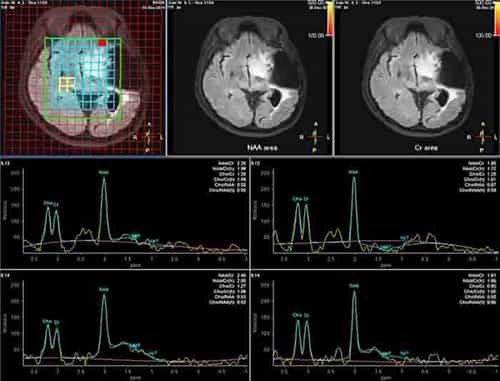 Diagnosticul de Mg face în prețurile de la Moscova, costul tomografiei magnetice