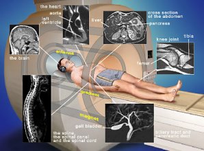 В Санкт Петербург MRI (магнитен резонанс)