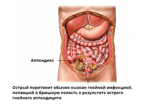 Bacteria sanatoasa-prostatita si relatia acesteia cu testosteronul