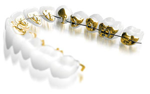 Нові технології в стоматології