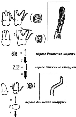 Особливості видалення окремих груп зубів щипцями - стоматологія, хірургія на альвеолярному