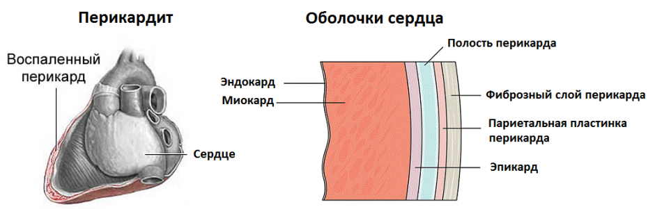 Edem pulmonar la cancer pulmonar și alte boli asociate cu acesta