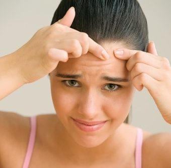 Acnee pe frunte - tratament, remedii populare