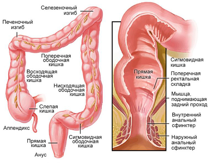 Simptomele și tratamentul simptomelor cancerului sigmoid