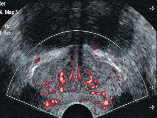 Locul urologului urologistului eugenia Bernikov, metodele de cercetare în urologie