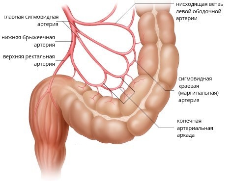 Сигмовиднакишка симптоми захворювань, лікування і дієта