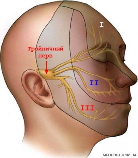 Sipmtomy gyulladás a háromosztatú ideg, medpost