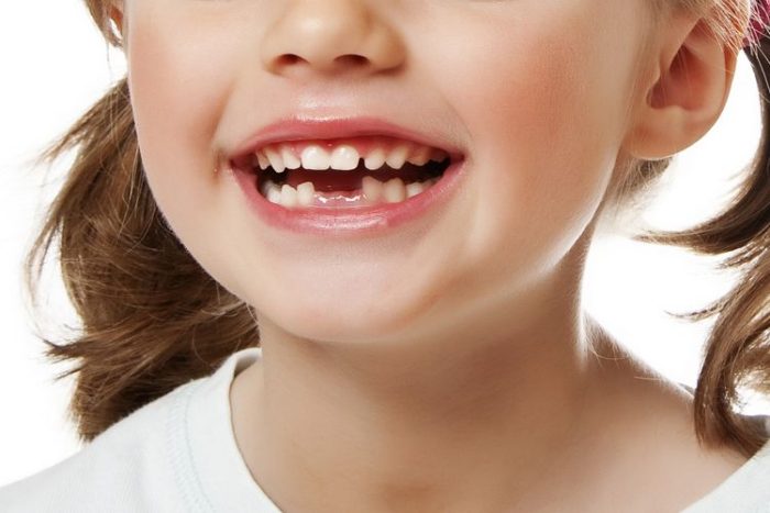 Câți dinți pot fi rupți pentru o vizită la medicul dentist