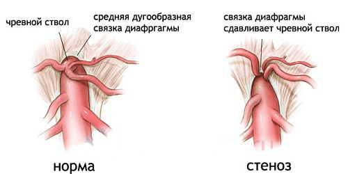 Traheea - aceasta este situația, structura, funcția