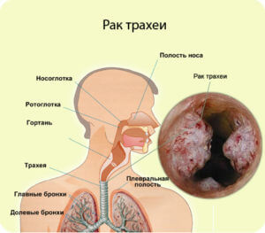 Трахея - це що таке, де розташована, будова, функція