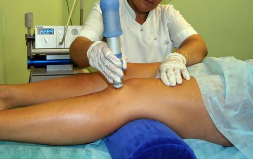 Lökéshullám terápia osteoarthritis előnye a közös hasznosítás (visszanyerés) Lökéshullám terápia osteoarthritis előnye a közös hasznosítás