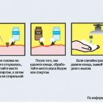 Укус шершня і його наслідки, фото і що робити в домашніх умовах перша допомога при укусах