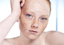 Freckles pe buze
