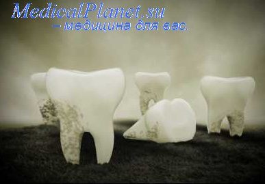 Види базисних пластмас в стоматології