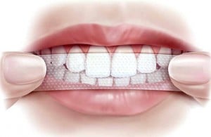 Чи шкідливо вибілювати зуби чим небезпечні смужки і перекис водню