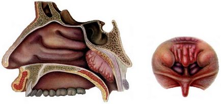 Adenoidele din nas ceea ce este