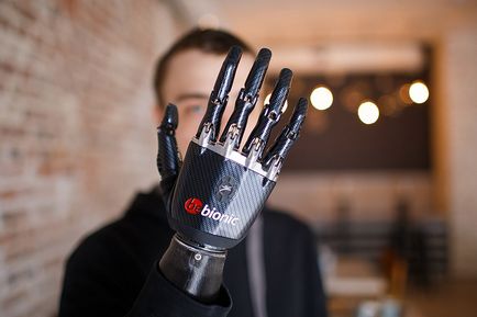 bionikus kéz
