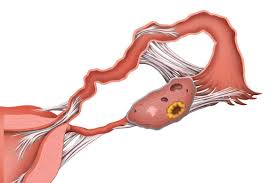 Boli ale organelor pelvine uzi pelvis mic, tratament și diagnostic în Moscova