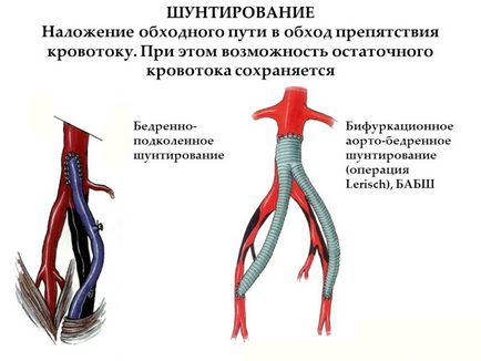 Чистка судин медикаментами, народними засобами, шляхом дієти