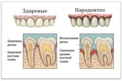 Десна просіла