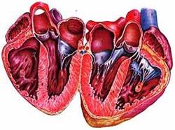 Hipertrofia ventriculului stâng al inimii