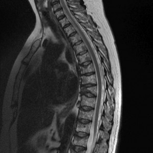 Mt al coloanei vertebrale toracice - informații despre studiu, indicații și contraindicații