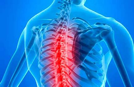 Mert a coloanei vertebrale toracice - necesitate, scop, contraindicații