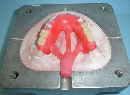 Principalele probleme în fabricarea protezelor flexibile