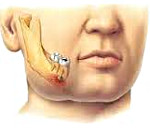 Abces periapical - cauze, simptome, diagnostic și tratament