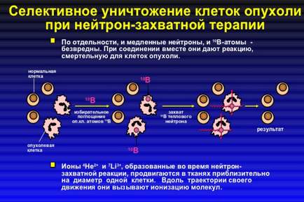 Перспективні методи лікування онкологічних захворювань в россии нейтронозахватної і протонна