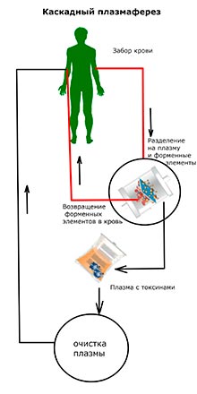 Plasmafereza - curățarea sângelui în Moscova