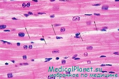 Structura mușchiului cardiac, histologie