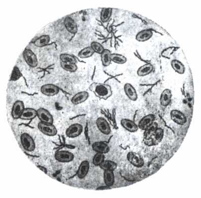 spirochetosis madarak